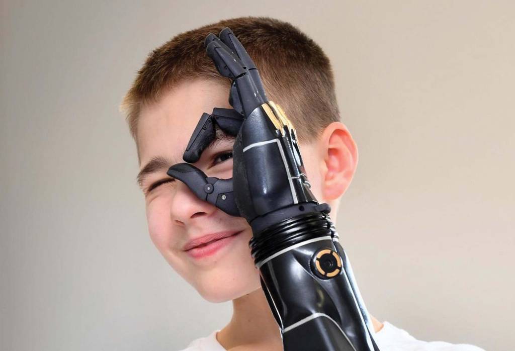 Protese Bionicas Protese Bionicas